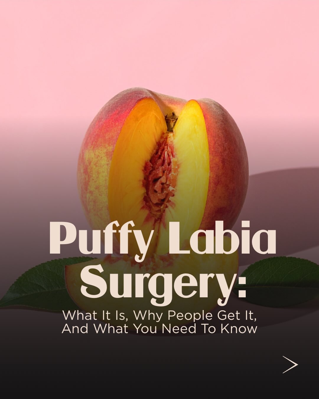 What IS puffy labia surgery? Find out on our website, link in bio 🍑