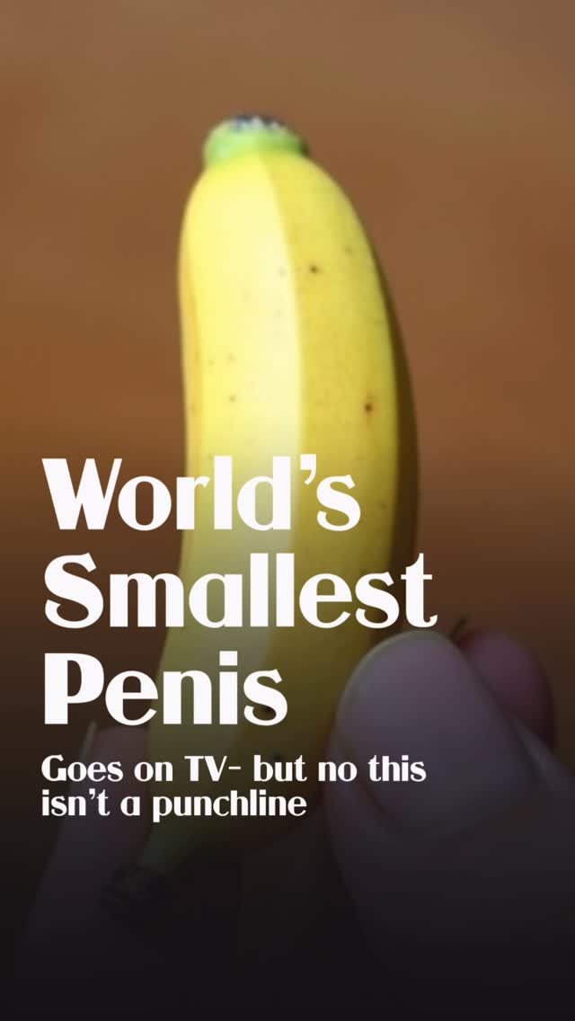 In a world obsessed with the size of a guy’s penis, one man is seeking the world record for a condition few would ever admit to publicly.…